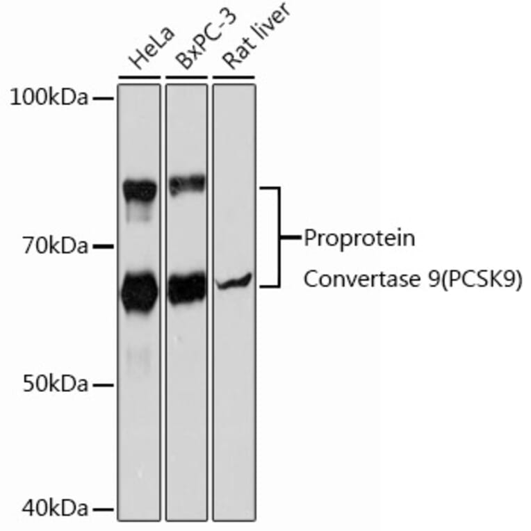 Western Blot - Anti-PCSK9 Antibody [ARC0695] (A307192) - Antibodies.com