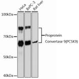 Western Blot - Anti-PCSK9 Antibody [ARC0695] (A307192) - Antibodies.com