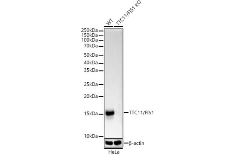Western Blot - Anti-TTC11/FIS1 Antibody [ARC5010-01] (A307193) - Antibodies.com