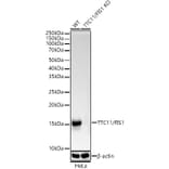 Western Blot - Anti-TTC11 / FIS1 Antibody [ARC5010-01] (A307193) - Antibodies.com