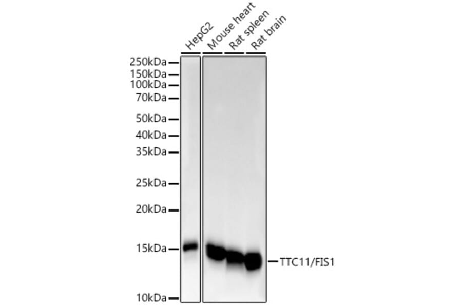 Western Blot - Anti-TTC11/FIS1 Antibody [ARC5010-01] (A307193) - Antibodies.com