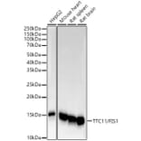 Western Blot - Anti-TTC11 / FIS1 Antibody [ARC5010-01] (A307193) - Antibodies.com