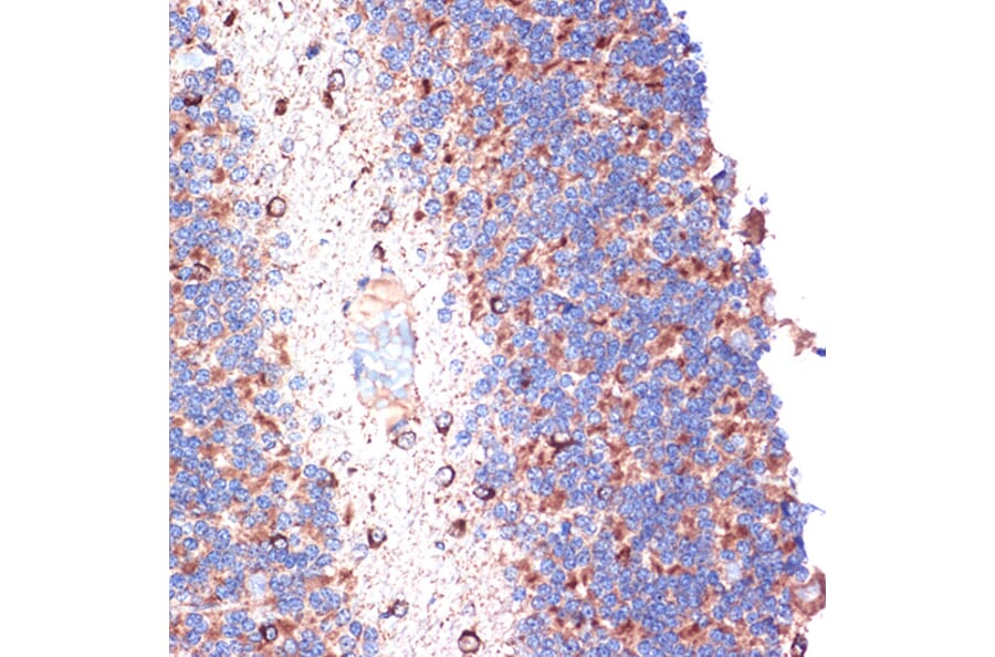 Immunohistochemistry - Anti-TTC11/FIS1 Antibody [ARC5010-01] (A307193) - Antibodies.com