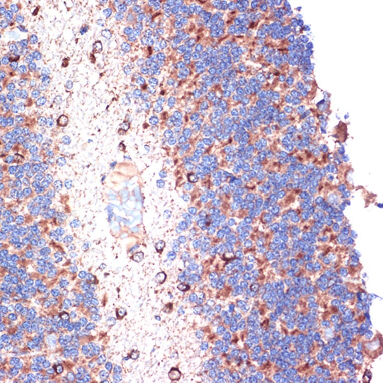 Immunohistochemistry - Anti-TTC11 / FIS1 Antibody [ARC5010-01] (A307193) - Antibodies.com