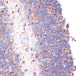 Immunohistochemistry - Anti-TTC11 / FIS1 Antibody [ARC5010-01] (A307193) - Antibodies.com