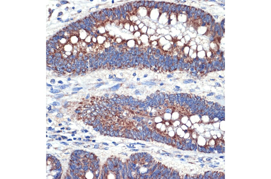 Immunohistochemistry - Anti-TTC11/FIS1 Antibody [ARC5010-01] (A307193) - Antibodies.com