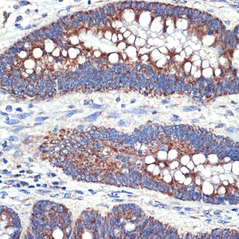 Immunohistochemistry - Anti-TTC11 / FIS1 Antibody [ARC5010-01] (A307193) - Antibodies.com