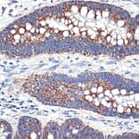 Immunohistochemistry - Anti-TTC11 / FIS1 Antibody [ARC5010-01] (A307193) - Antibodies.com