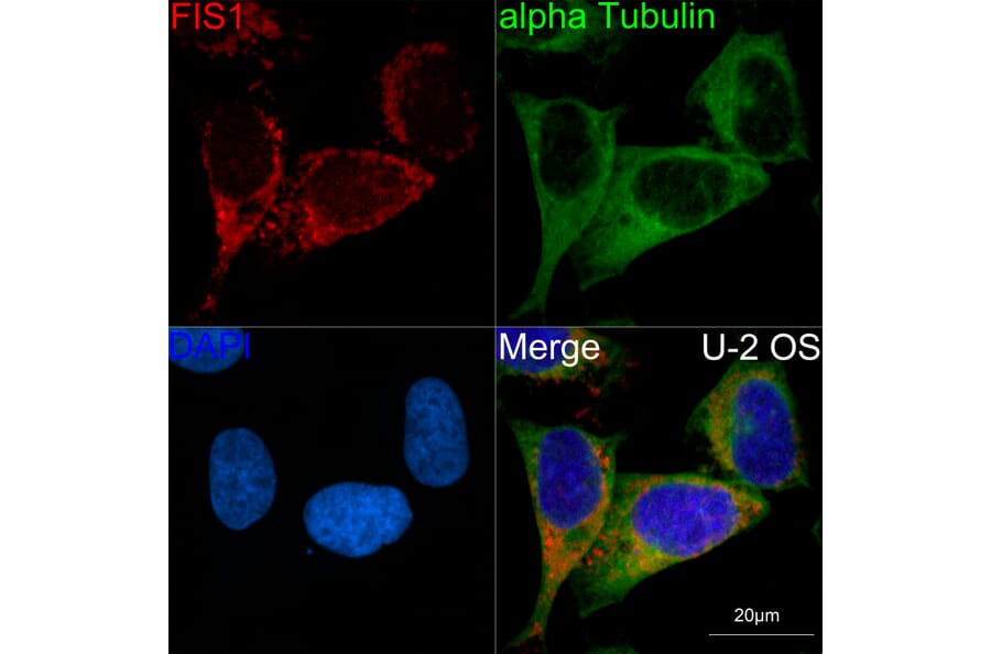 Immunofluorescence - Anti-TTC11/FIS1 Antibody [ARC5010-01] (A307193) - Antibodies.com