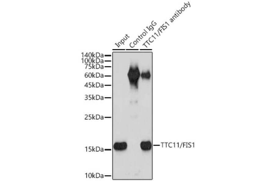 Western Blot - Anti-TTC11/FIS1 Antibody [ARC5010-01] (A307193) - Antibodies.com