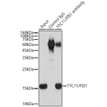 Western Blot - Anti-TTC11 / FIS1 Antibody [ARC5010-01] (A307193) - Antibodies.com