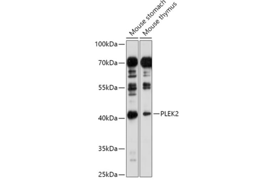 Western Blot - Anti-PLEK2 Antibody (A307199) - Antibodies.com