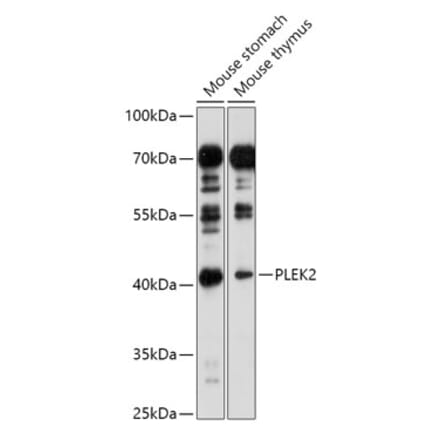 Western Blot - Anti-PLEK2 Antibody (A307199) - Antibodies.com