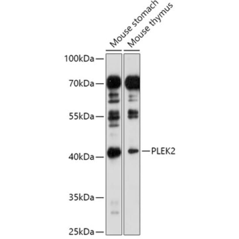 Western Blot - Anti-PLEK2 Antibody (A307199) - Antibodies.com