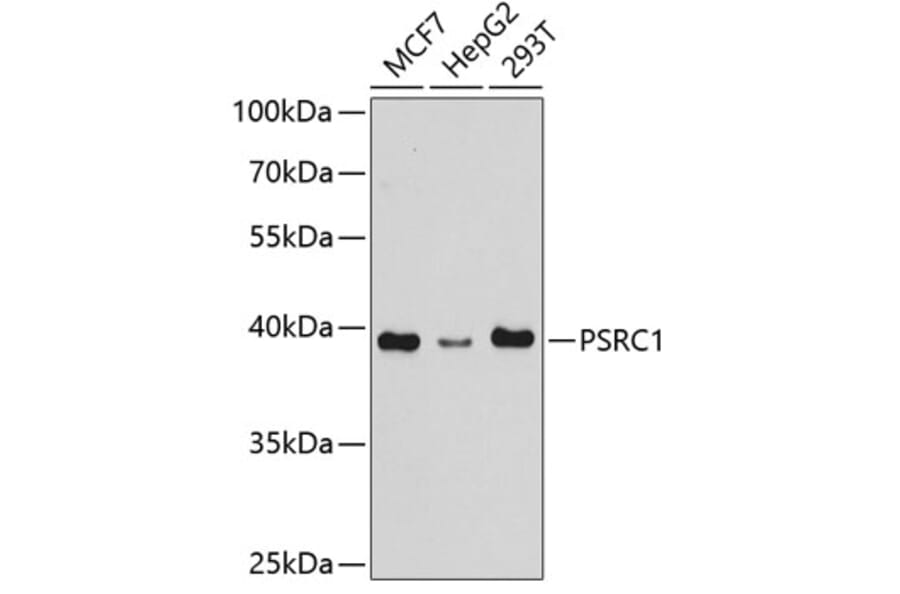 Western Blot - Anti-PSRC1/DDA3 Antibody (A307201) - Antibodies.com