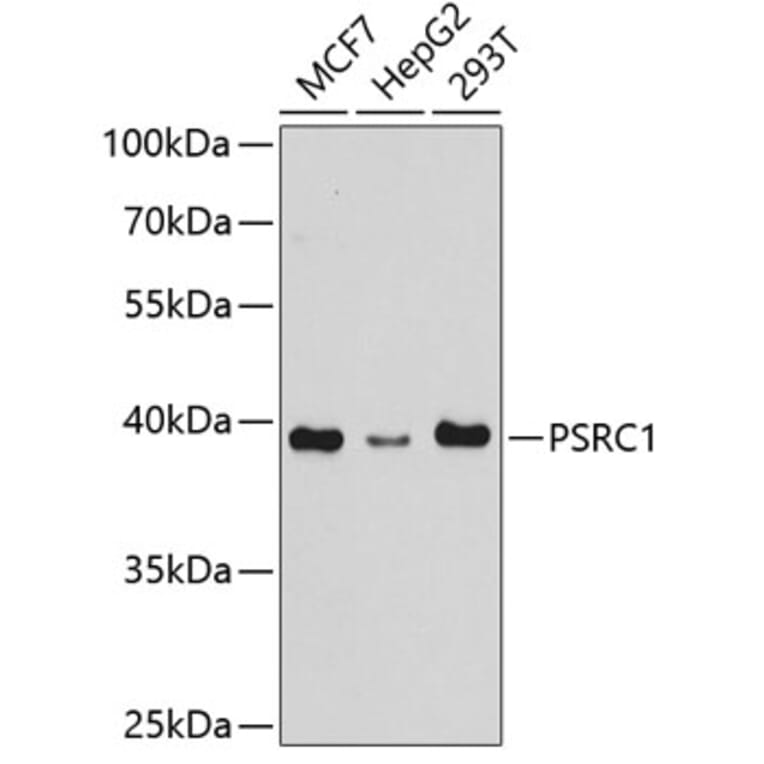 Western Blot - Anti-PSRC1/DDA3 Antibody (A307201) - Antibodies.com
