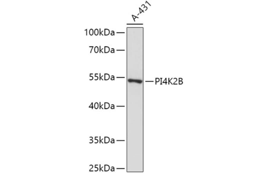 Western Blot - Anti-PI4K2B Antibody (A307202) - Antibodies.com