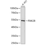 Western Blot - Anti-PI4K2B Antibody (A307202) - Antibodies.com