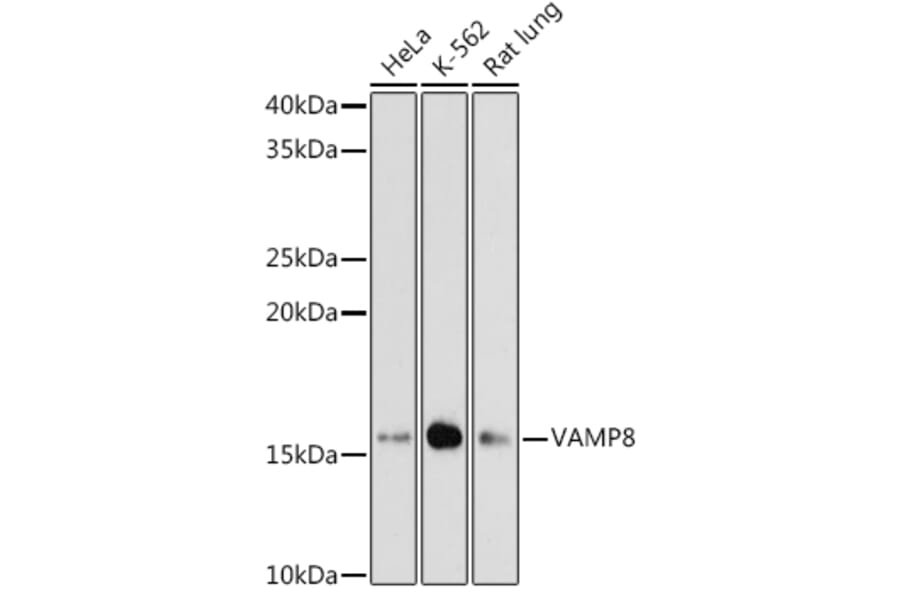 Western Blot - Anti-VAMP8/EDB Antibody [ARC1108] (A307203) - Antibodies.com