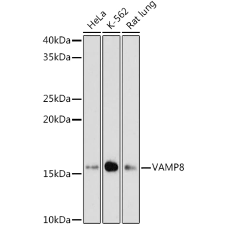 Western Blot - Anti-VAMP8/EDB Antibody [ARC1108] (A307203) - Antibodies.com