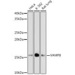 Western Blot - Anti-VAMP8/EDB Antibody [ARC1108] (A307203) - Antibodies.com