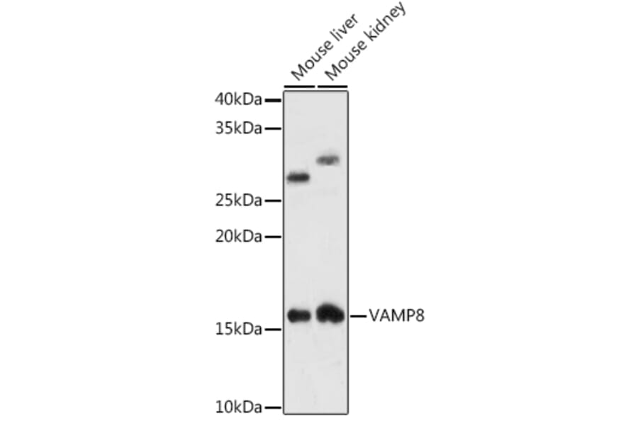 Western Blot - Anti-VAMP8/EDB Antibody [ARC1108] (A307203) - Antibodies.com