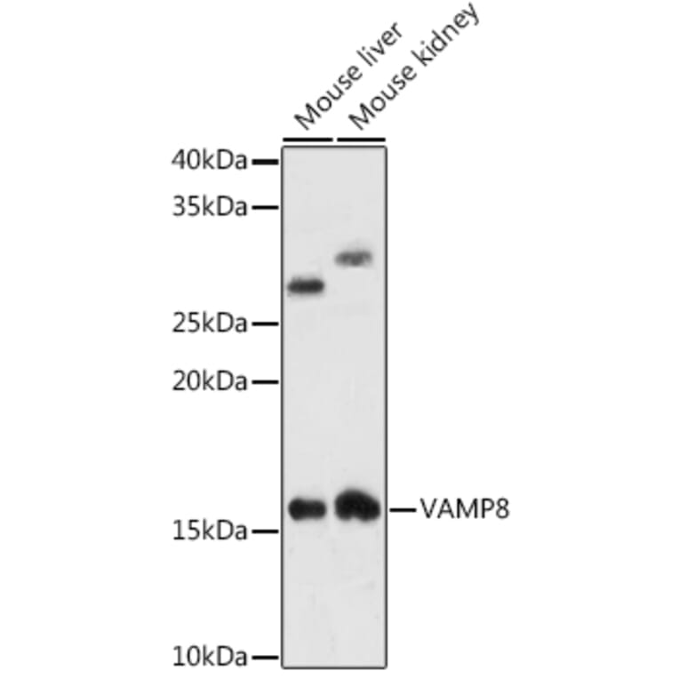 Western Blot - Anti-VAMP8/EDB Antibody [ARC1108] (A307203) - Antibodies.com