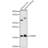 Western Blot - Anti-VAMP8/EDB Antibody [ARC1108] (A307203) - Antibodies.com