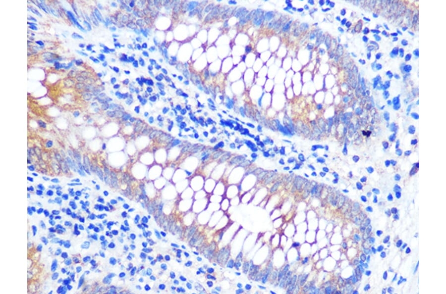 Immunohistochemistry - Anti-VAMP8/EDB Antibody [ARC1108] (A307203) - Antibodies.com