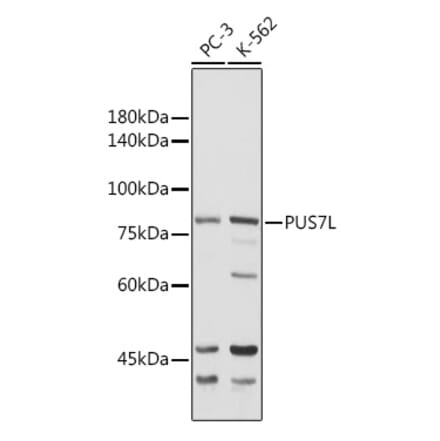 Western Blot - Anti-PUS7L Antibody (A307204) - Antibodies.com