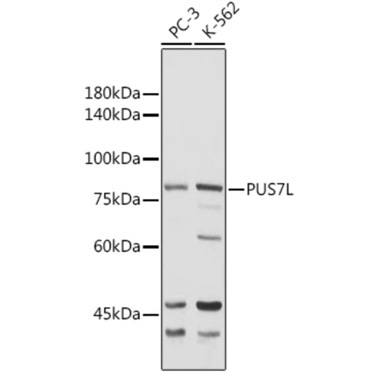 Western Blot - Anti-PUS7L Antibody (A307204) - Antibodies.com