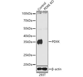 Western Blot - Anti-PDXK.1 Antibody (A307205) - Antibodies.com
