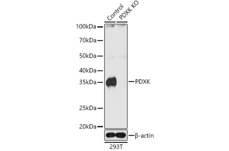 Western Blot - Anti-PDXK.1 Antibody (A307205) - Antibodies.com