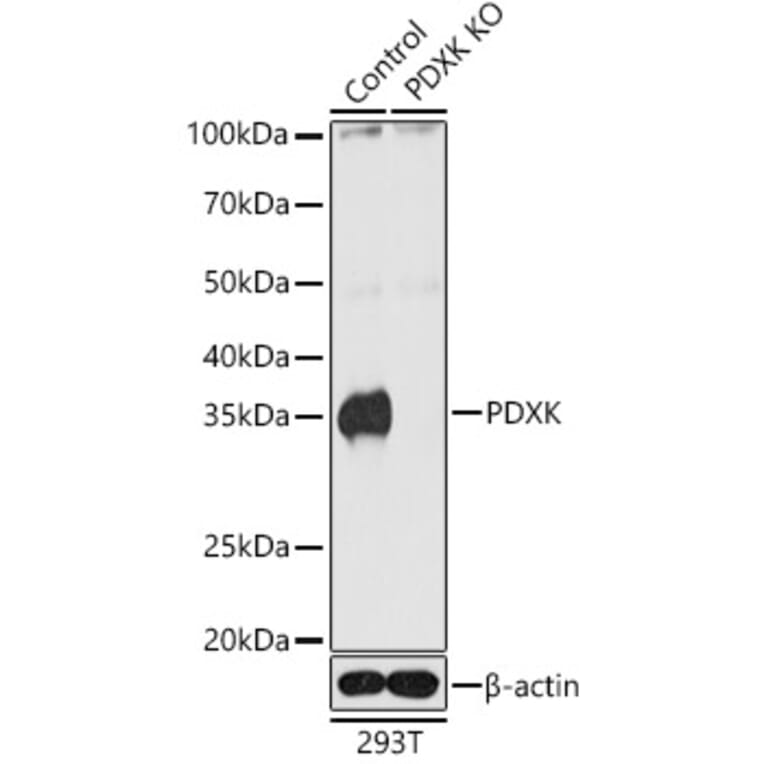 Western Blot - Anti-PDXK.1 Antibody (A307205) - Antibodies.com