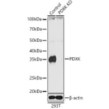 Western Blot - Anti-PDXK.1 Antibody (A307205) - Antibodies.com