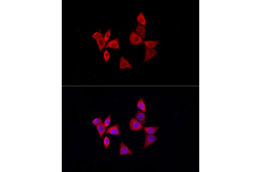 Immunofluorescence - Anti-PDXK.1 Antibody (A307205) - Antibodies.com