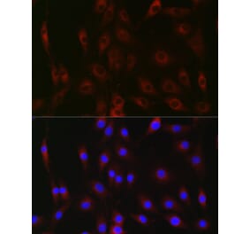 Immunofluorescence - Anti-G-6-Pase Antibody (A307206) - Antibodies.com