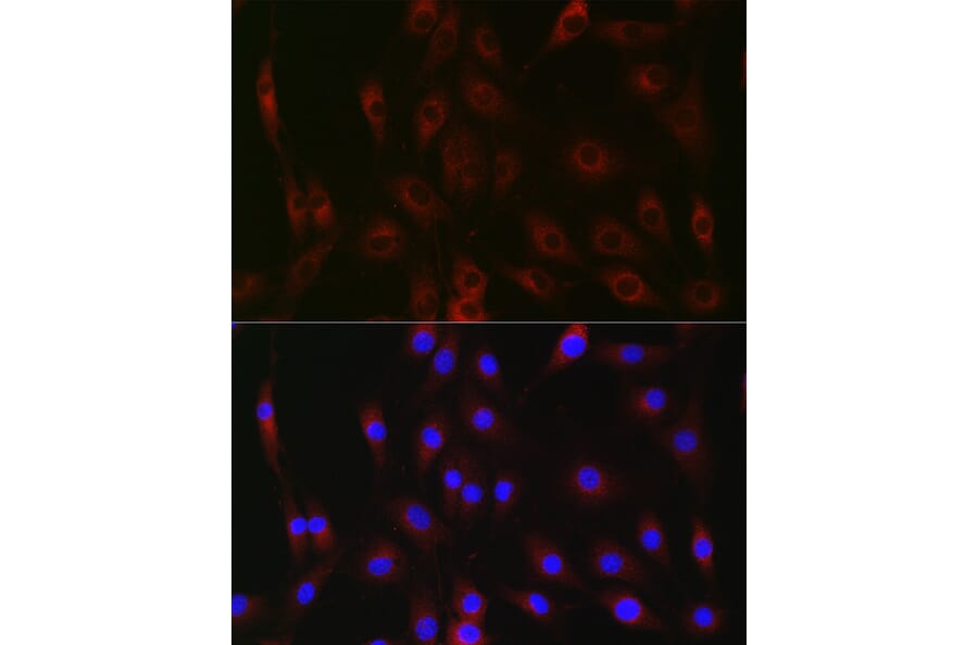 Immunofluorescence - Anti-G-6-Pase Antibody (A307206) - Antibodies.com
