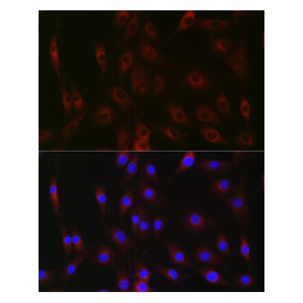 Immunofluorescence - Anti-G-6-Pase Antibody (A307206) - Antibodies.com