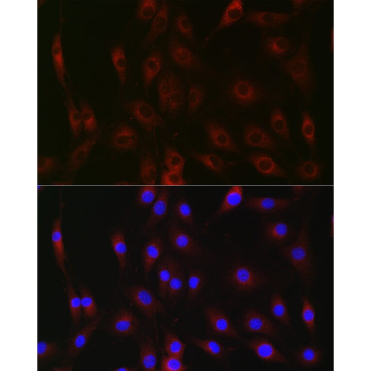 Immunofluorescence - Anti-G-6-Pase Antibody (A307206) - Antibodies.com