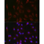 Immunofluorescence - Anti-G-6-Pase Antibody (A307206) - Antibodies.com