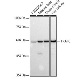 Western Blot - Anti-TRAF6 Antibody (A307207) - Antibodies.com
