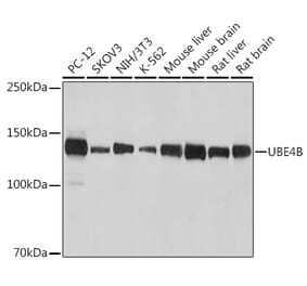 Western Blot - Anti-UBE4B Antibody [ARC2503] (A307210) - Antibodies.com