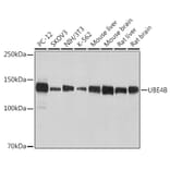 Western Blot - Anti-UBE4B Antibody [ARC2503] (A307210) - Antibodies.com