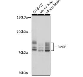 Western Blot - Anti-FMRP Antibody [ARC1026] (A307211) - Antibodies.com