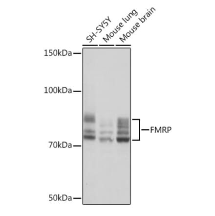 Western Blot - Anti-FMRP Antibody [ARC1026] (A307211) - Antibodies.com