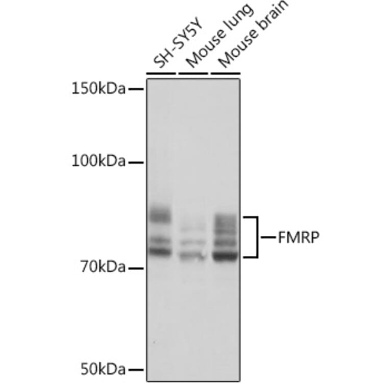 Western Blot - Anti-FMRP Antibody [ARC1026] (A307211) - Antibodies.com