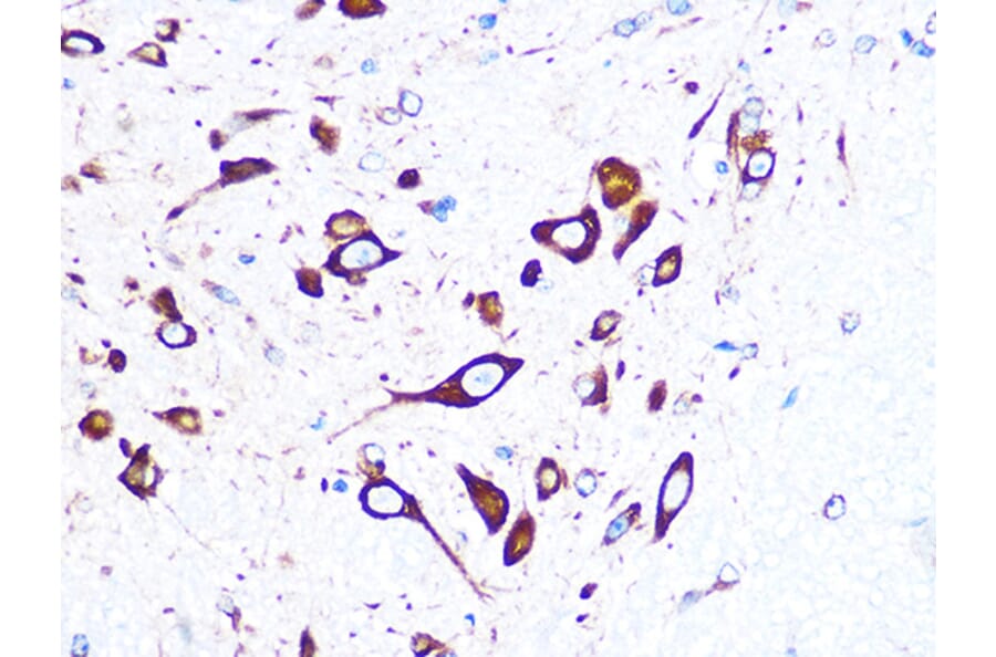 Immunohistochemistry - Anti-FMRP Antibody [ARC1026] (A307211) - Antibodies.com