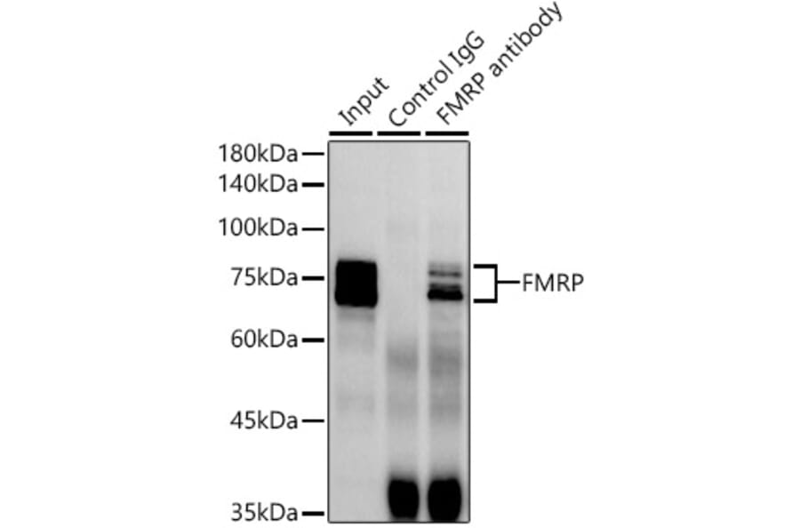 Western Blot - Anti-FMRP Antibody [ARC1026] (A307211) - Antibodies.com