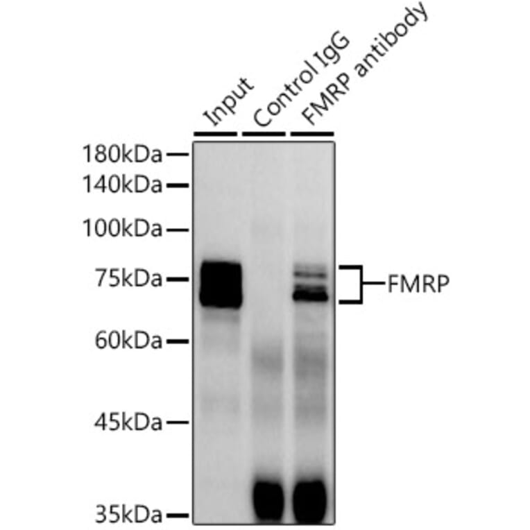 Western Blot - Anti-FMRP Antibody [ARC1026] (A307211) - Antibodies.com